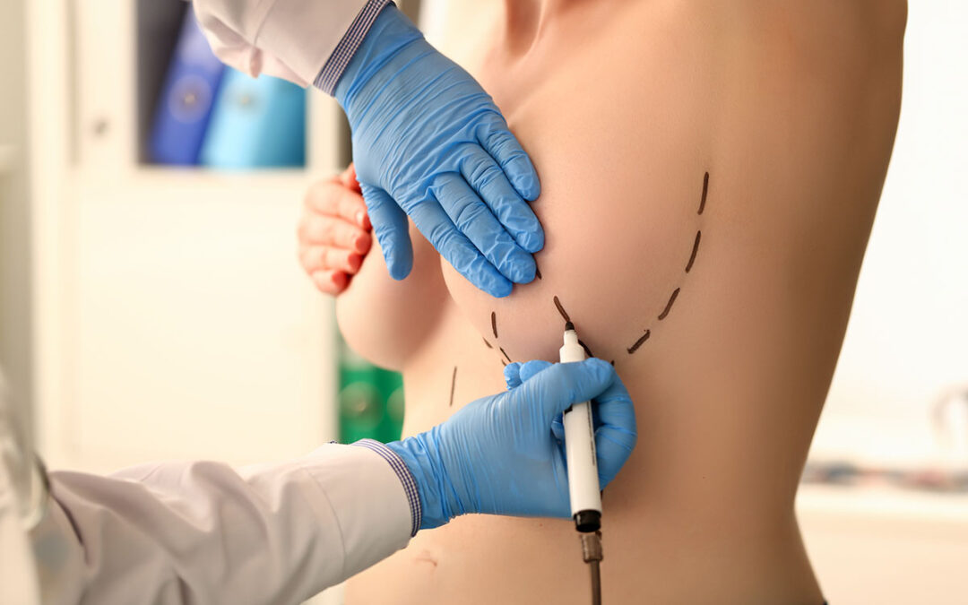 Preparation surgery method markup cut correction